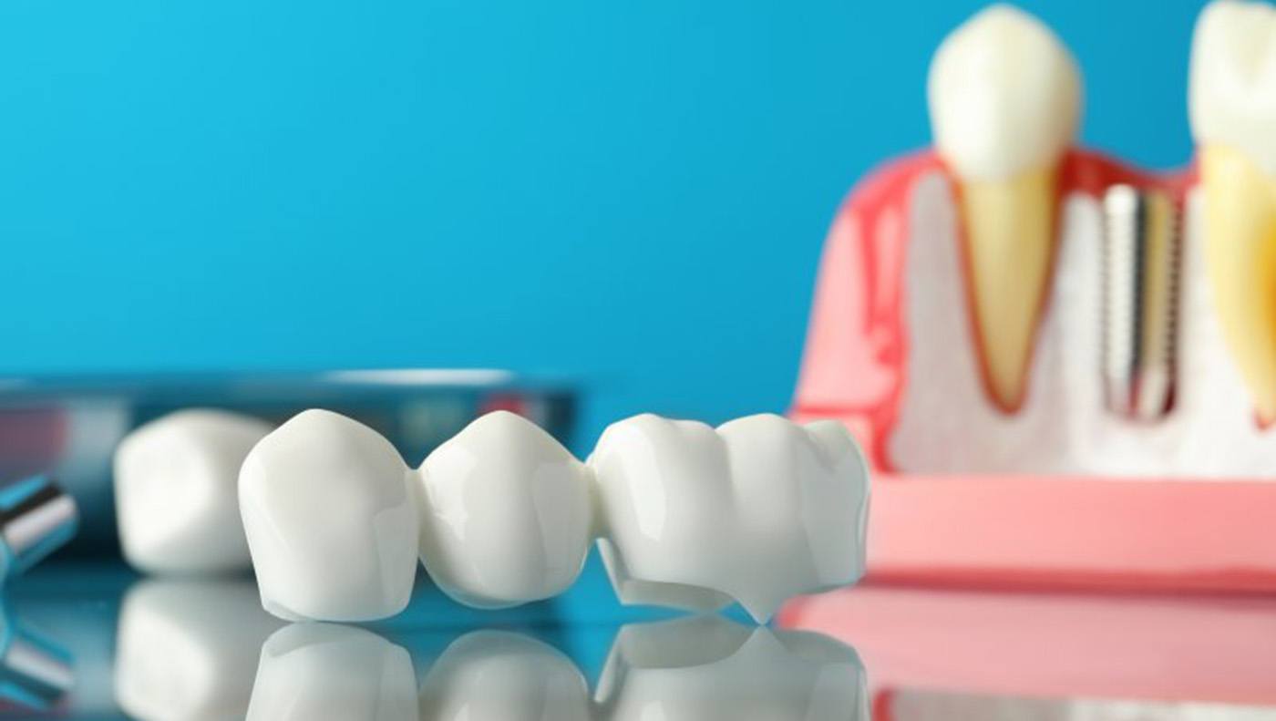 a dental bridge on a reflective table